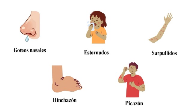 sintomas alergias - goteos nasales, estornudos, sarpullidos, hinchazon, picor