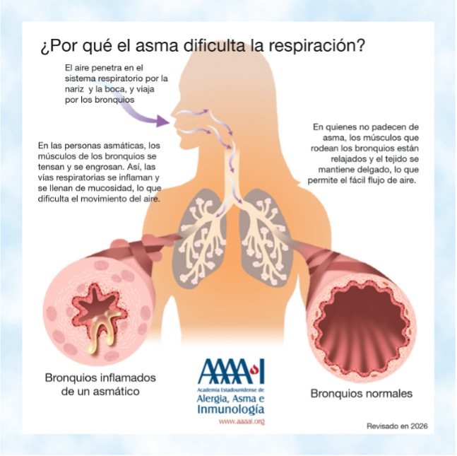 infografico datos sobre asma